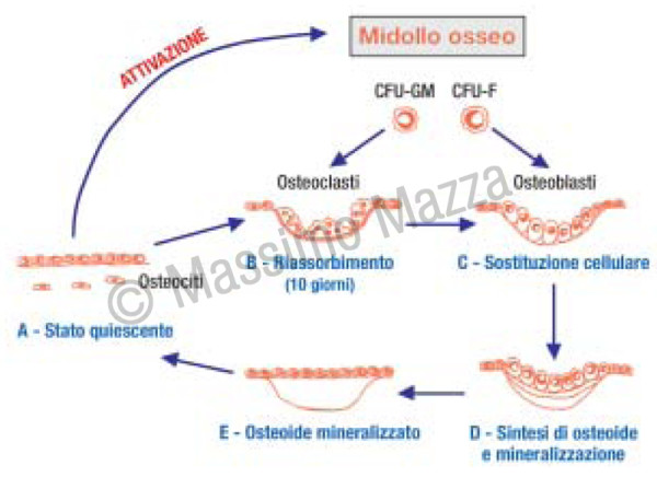 Valutazione metabolica dell’osso in chirurgia orale