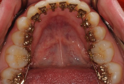 Dr. Massimo Mazza - L'ortodonzia